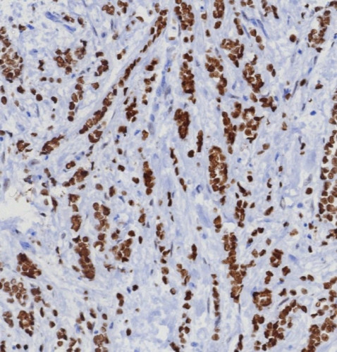 TRPS1 (Transcriptional repressor GATA binding 1) Antibody in Immunohistochemistry (Paraffin) (IHC (P))