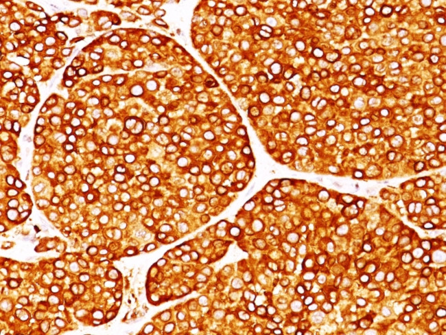 Tyrosinase (Melanoma Marker) Antibody in Immunohistochemistry (Paraffin) (IHC (P))