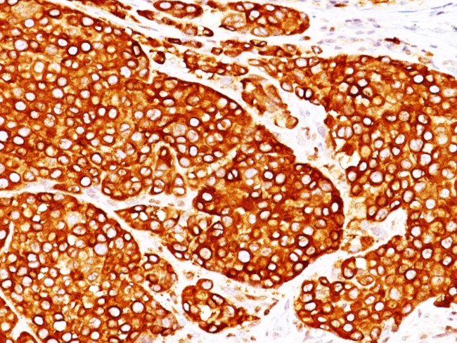 Tyrosinase (Melanoma Marker) Antibody in Immunohistochemistry (Paraffin) (IHC (P))