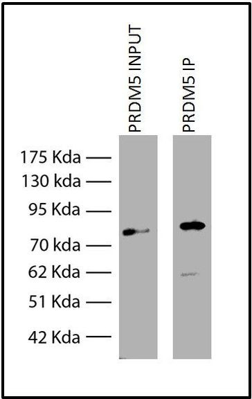 PRDM5 Antibody in Immunoprecipitation (IP)