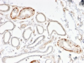 GTF2H2C (Transcription Factor) Antibody in Immunohistochemistry (Paraffin) (IHC (P))