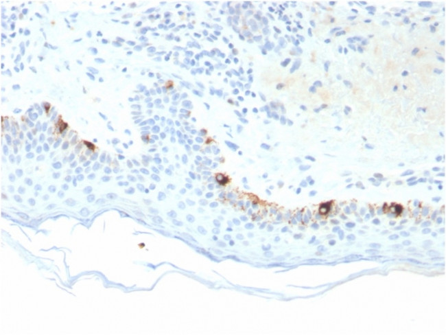 Tyrosinase-Related Protein-1 (TYRP-1) (Melanoma Marker) Antibody in Immunohistochemistry (Paraffin) (IHC (P))