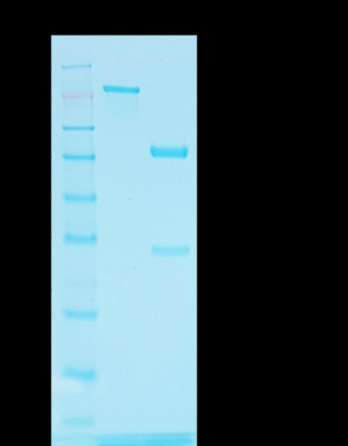 Tyrosinase-Related Protein-1 (TYRP-1) (Melanoma Marker) Antibody in SDS-PAGE (SDS-PAGE)