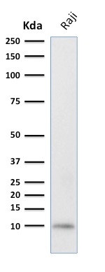 Ubiquitin (Autophagy Marker) Antibody in Western Blot (WB)