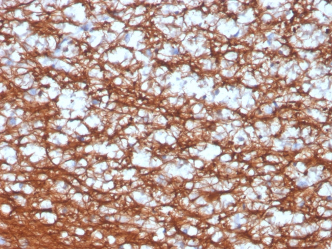 PGP9.5/UchL1 Antibody in Immunohistochemistry (Paraffin) (IHC (P))