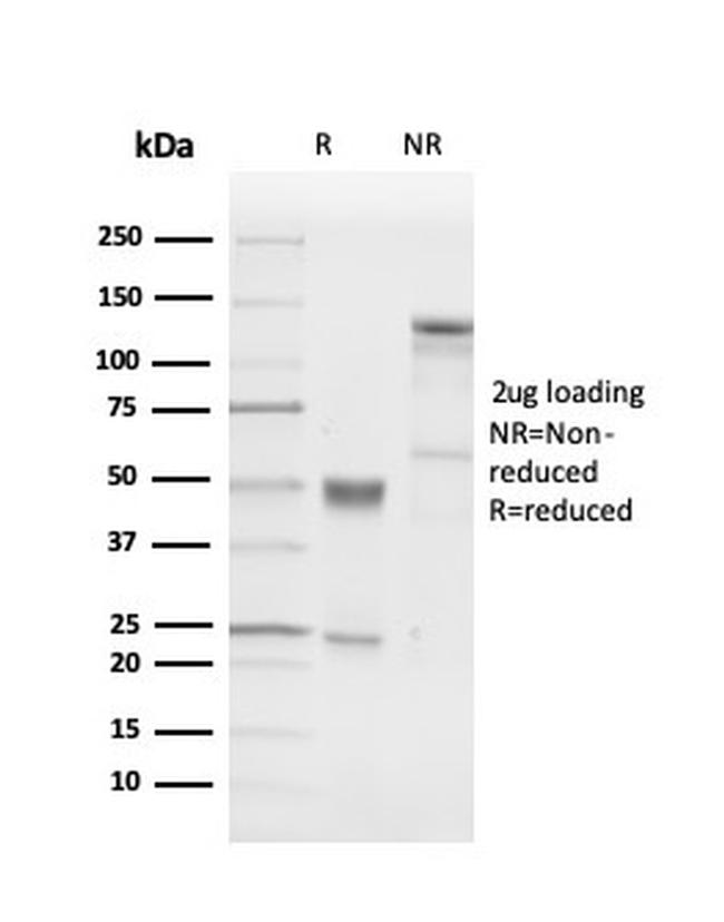 PGP9.5/UchL1 Antibody in SDS-PAGE (SDS-PAGE)