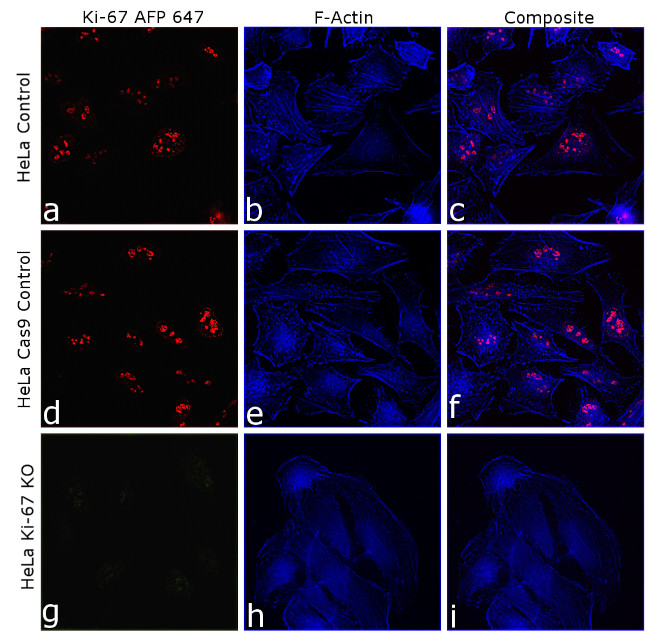 Ki-67 Antibody in Immunocytochemistry (ICC/IF)