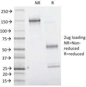 Villin (GI-Mucosal and Urogenital Brush Border Marker) Antibody in SDS-PAGE (SDS-PAGE)