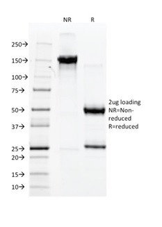 von Willebrand Factor/Factor VIII Related-Ag (Endothelial Marker) Antibody in SDS-PAGE (SDS-PAGE)