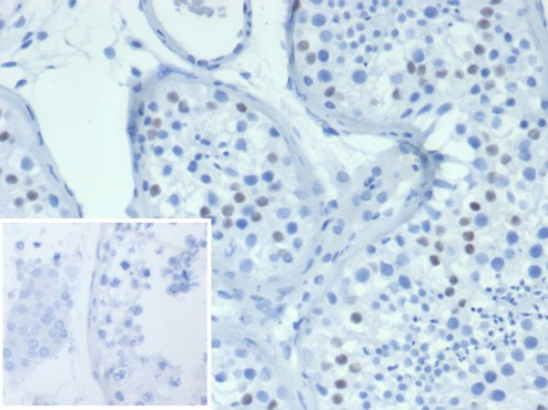 Wilm's Tumor 1 (WT1) (Wilm's Tumor and Mesothelial Marker) Antibody in Immunohistochemistry (Paraffin) (IHC (P))