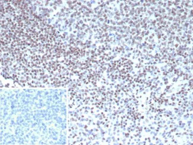 YY1 (Transcription Factor) Antibody in Immunohistochemistry (Paraffin) (IHC (P))