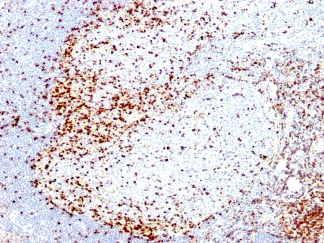 ZAP70 (Chronic Lymphocytic Leukemia Marker) Antibody in Immunohistochemistry (Paraffin) (IHC (P))