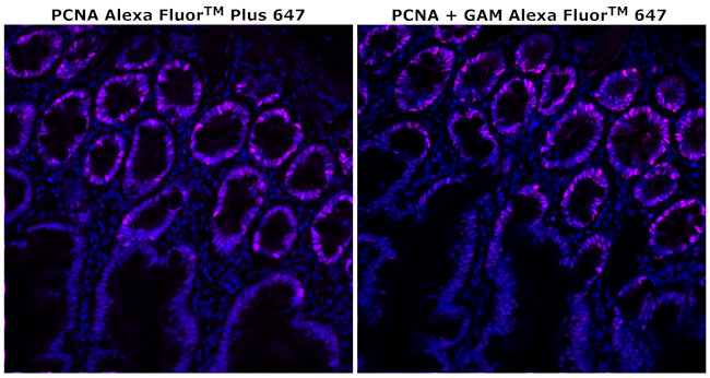 PCNA Antibody in Immunohistochemistry (Paraffin) (IHC (P))