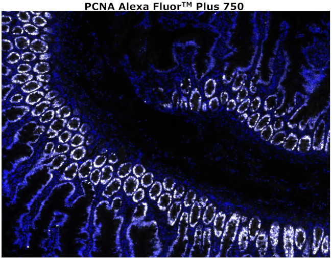 PCNA Antibody in Immunohistochemistry (Paraffin) (IHC (P))