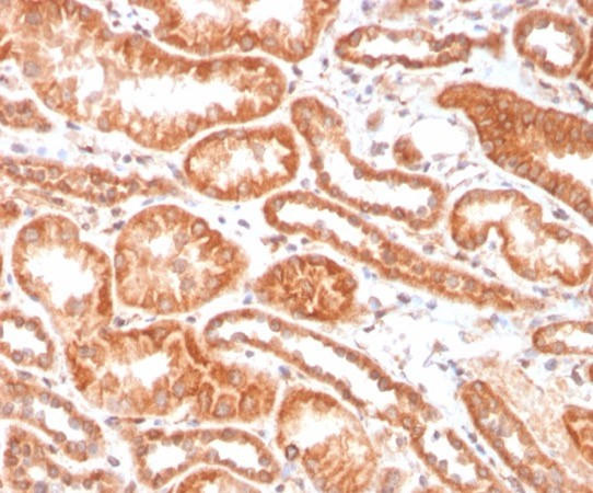 Renal Cell Carcinoma (Carbonic Anhydrase IX) Antibody in Immunohistochemistry (Paraffin) (IHC (P))