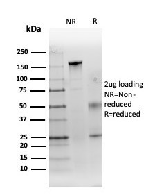 Renal Cell Carcinoma (Carbonic Anhydrase IX) Antibody in SDS-PAGE (SDS-PAGE)