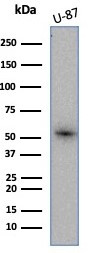 Renal Cell Carcinoma (Carbonic Anhydrase IX) Antibody in Western Blot (WB)