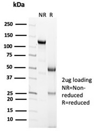 Calretinin/Calbindin 2 (Mesothelioma Marker) Antibody in SDS-PAGE (SDS-PAGE)