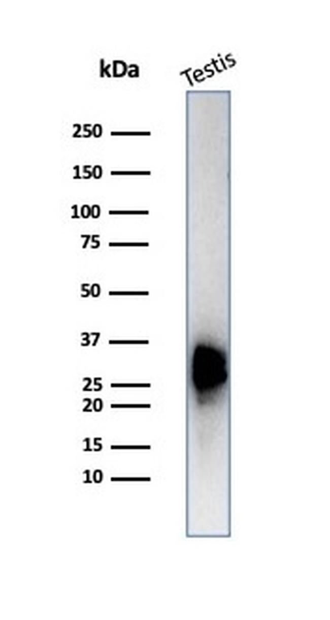 Calretinin/Calbindin 2 (Mesothelioma Marker) Antibody in Western Blot (WB)