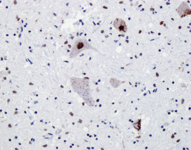 TDP-43 Antibody in Immunohistochemistry (IHC)