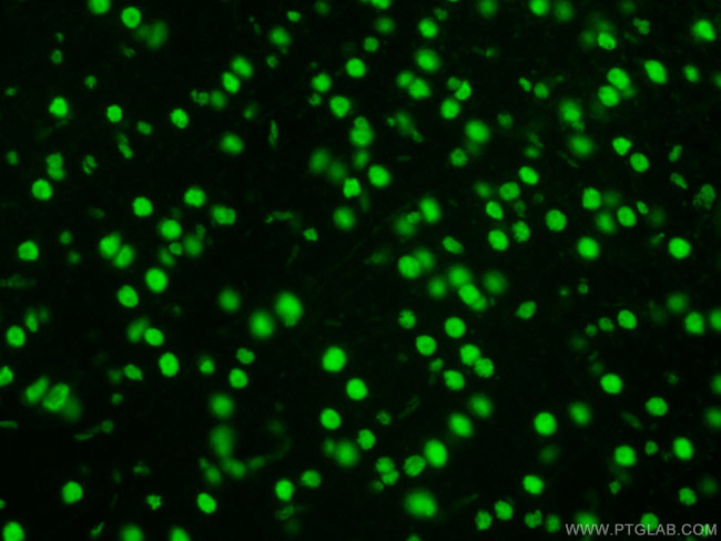 TDP-43 Antibody in Immunohistochemistry (Paraffin) (IHC (P))