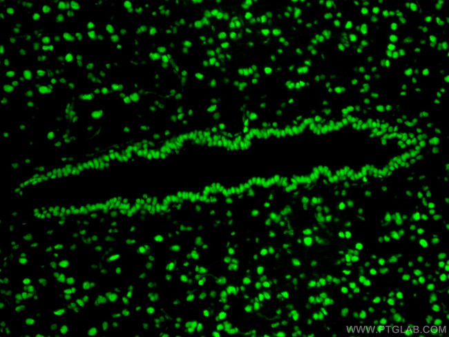 TDP-43 Antibody in Immunohistochemistry (Paraffin) (IHC (P))