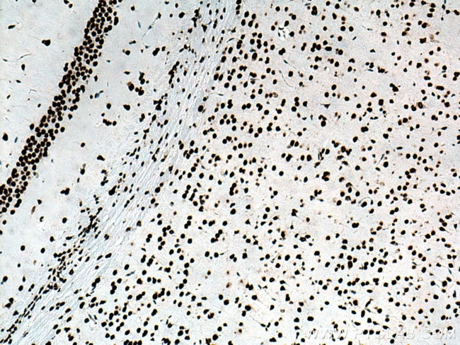 TDP-43 Antibody in Immunohistochemistry (Paraffin) (IHC (P))