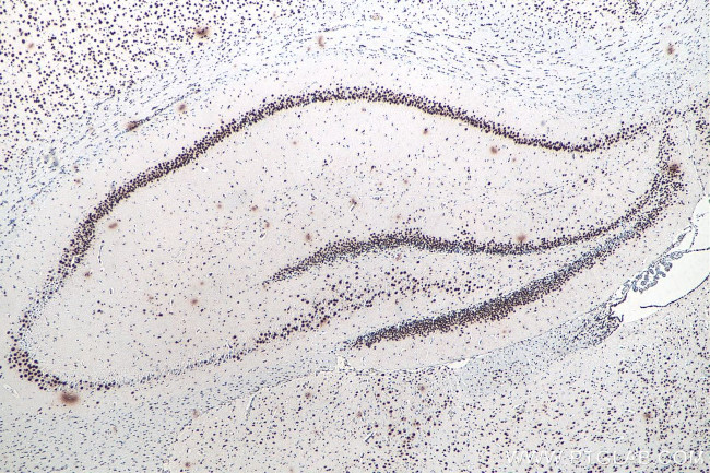 TDP-43 Antibody in Immunohistochemistry (Paraffin) (IHC (P))