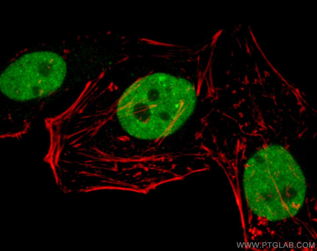 TDP-43 Antibody in Immunocytochemistry (ICC/IF)