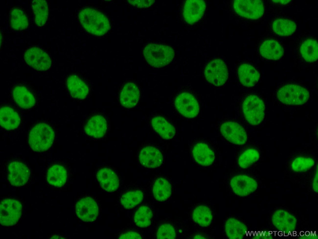 TDP-43 Antibody in Immunocytochemistry (ICC/IF)