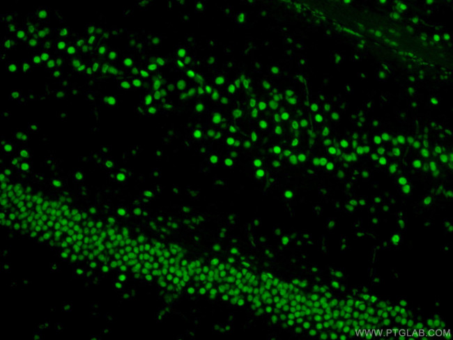 TDP-43 Antibody in Immunohistochemistry (Paraffin) (IHC (P))