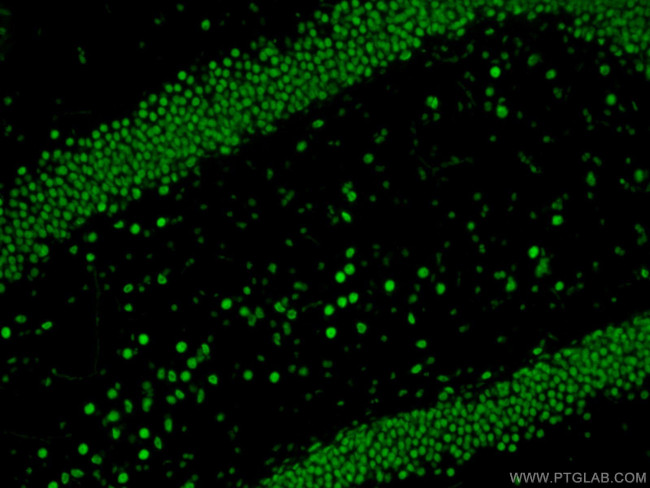 TDP-43 Antibody in Immunohistochemistry (Paraffin) (IHC (P))