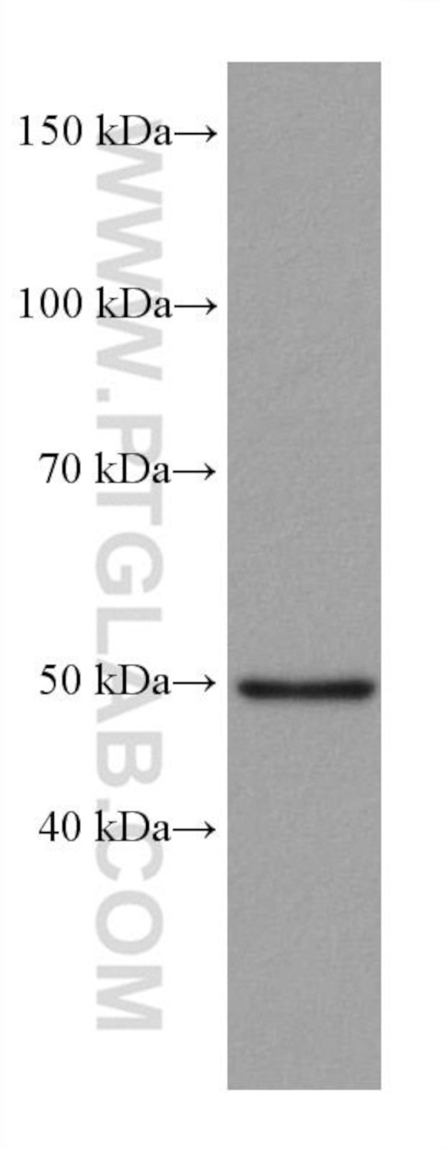 P53 Antibody in Western Blot (WB)