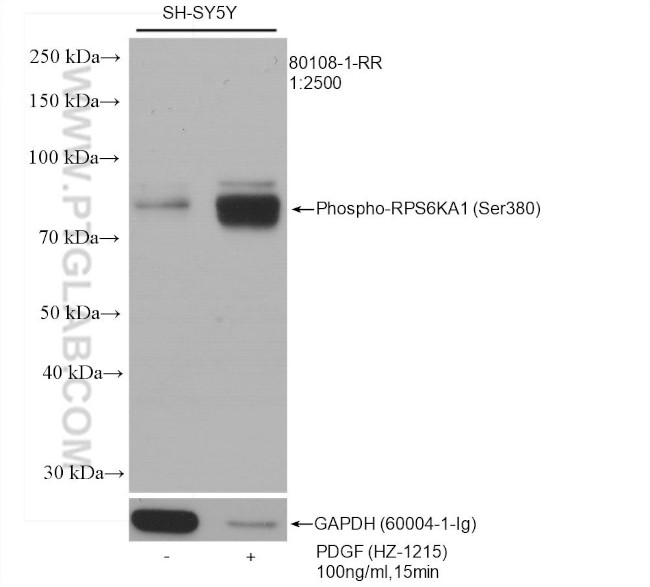 Phospho-RPS6KA1 (Ser380) Antibody in Western Blot (WB)