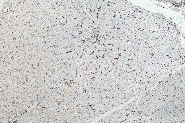 TMEM173/STING Antibody in Immunohistochemistry (Paraffin) (IHC (P))