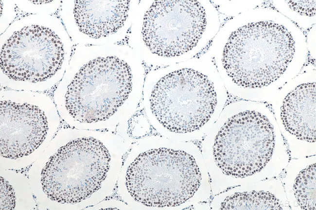 METTL3 Antibody in Immunohistochemistry (Paraffin) (IHC (P))