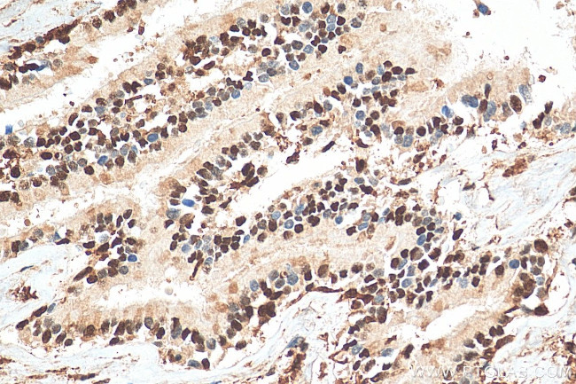 GAPDH Antibody in Immunohistochemistry (Paraffin) (IHC (P))