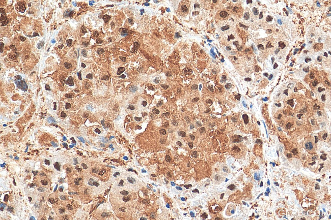 GAPDH Antibody in Immunohistochemistry (Paraffin) (IHC (P))