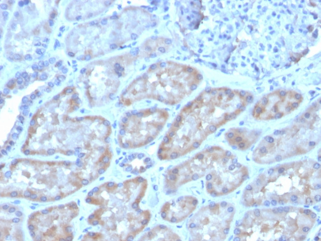 FGF23 (Fibroblast Growth Factor 23) Antibody in Immunohistochemistry (Paraffin) (IHC (P))