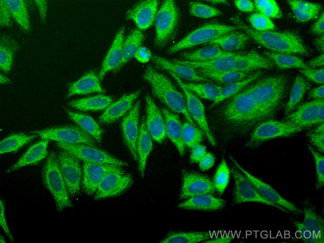 NF-kappa B p65 Antibody in Immunocytochemistry (ICC/IF)