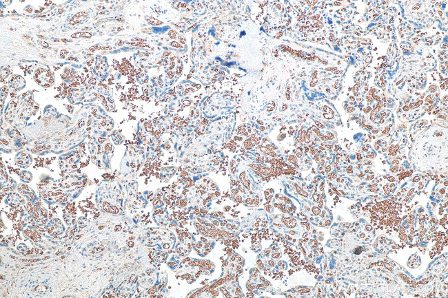 Band 3/AE1 Antibody in Immunohistochemistry (Paraffin) (IHC (P))