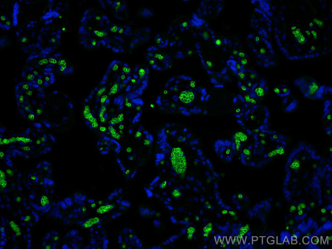 Band 3/AE1 Antibody in Immunohistochemistry (PFA fixed) (IHC (PFA))