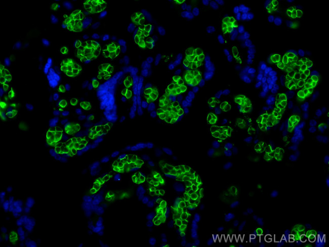 Band 3/AE1 Antibody in Immunohistochemistry (PFA fixed) (IHC (PFA))