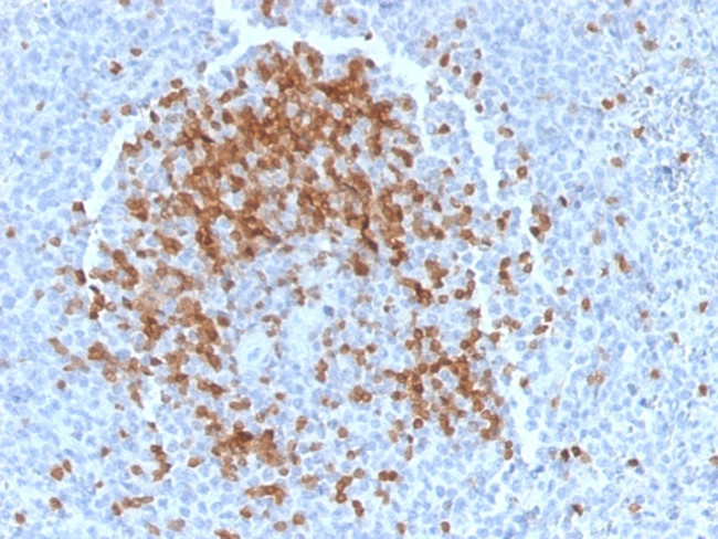 TCL1 Antibody in Immunohistochemistry (Paraffin) (IHC (P))