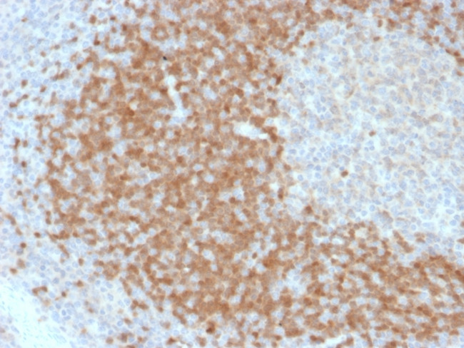 TCL1 Antibody in Immunohistochemistry (Paraffin) (IHC (P))