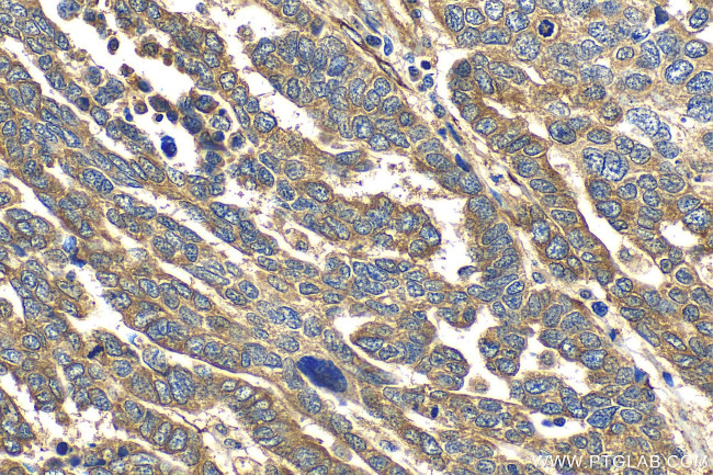 FKBP10/FKBP65 Antibody in Immunohistochemistry (Paraffin) (IHC (P))