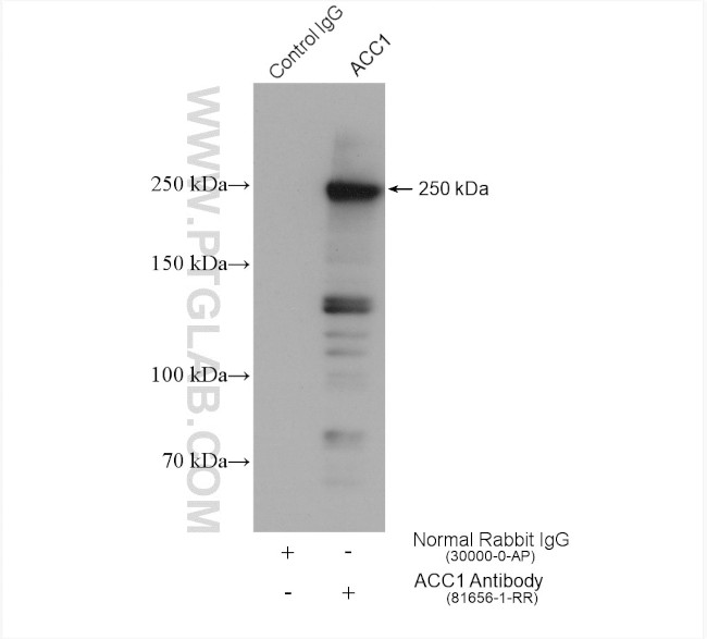 ACC1 Antibody in Immunoprecipitation (IP)