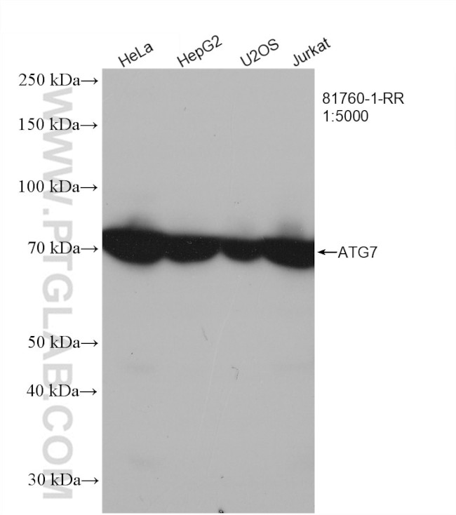 ATG7 Antibody in Western Blot (WB)