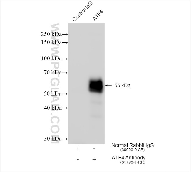 ATF4 Antibody in Immunoprecipitation (IP)