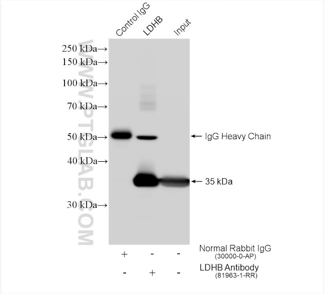 LDHB Antibody in Immunoprecipitation (IP)